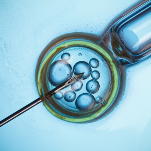 Why Sperm Quality Matters for IVF and ICSI